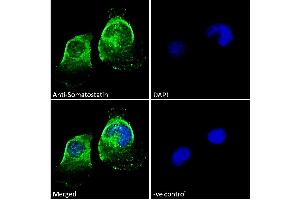 Image no. 1 for anti-Somatostatin (SST) (AA 58-70) antibody (ABIN7013881)
