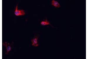Image no. 2 for anti-Heat Shock 70kDa Protein 1-Like (HSPA1L) antibody (ABIN6262409)