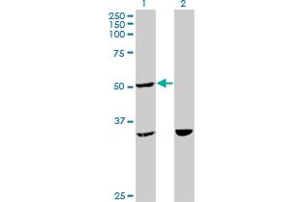 TTC4 Antikörper  (AA 1-100)