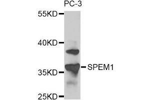 Image no. 1 for anti-Spermatid Maturation 1 (SPEM1) antibody (ABIN2737577)