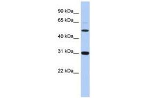 Image no. 1 for anti-Peptidase Inhibitor 16 (PI16) (C-Term) antibody (ABIN6743848)