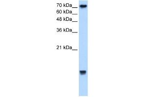 Image no. 1 for anti-Ubiquitin-Conjugating Enzyme E2N (UBE2N) antibody (ABIN629720)