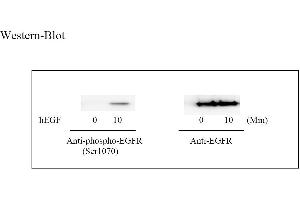 Image no. 3 for Epidermal Growth Factor Receptor (EGFR) ELISA Kit (ABIN625234)
