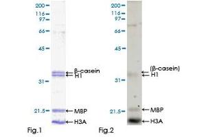 Calcium/calmodulin-Dependent Protein Kinase IG (CAMK1G) (AA 1-476) protein (GST tag)