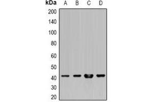 Image no. 1 for anti-Major Histocompatibility Complex, Class I, A (HLA-A) antibody (ABIN2966716)