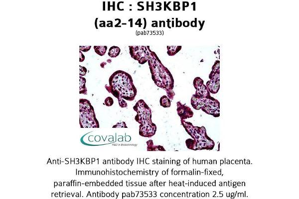 anti-SH3-Domain Kinase Binding Protein 1 (SH3KBP1) (AA 2-14), (N-Term) antibody