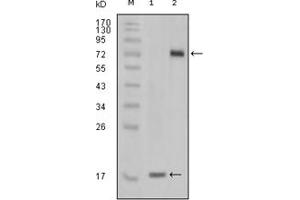 Image no. 1 for anti-serine/threonine/tyrosine Kinase 1 (STYK1) antibody (ABIN1109166)