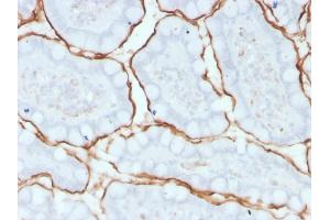 Image no. 3 for anti-Angiotensin I Converting Enzyme (Peptidyl-Dipeptidase A) 1 (ACE) antibody (ABIN6939231)