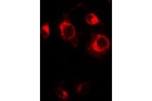 Image no. 2 for anti-Golgi Reassembly Stacking Protein 1, 65kDa (GORASP1) (full length) antibody (ABIN6043494)