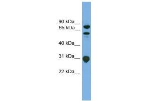 anti-SH3-Domain Kinase Binding Protein 1 (SH3KBP1) (N-Term) antibody