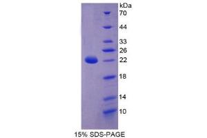 Image no. 1 for Keratin 18 (KRT18) (AA 1-159) protein (His tag) (ABIN2125553)