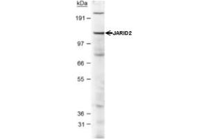 Image no. 2 for anti-Jumonji, AT Rich Interactive Domain 2 (JARID2) (AA 1-100), (N-Term) antibody (ABIN1951845)