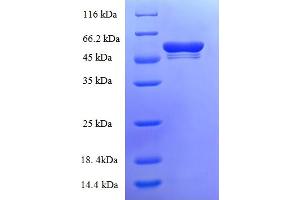 Image no. 1 for Tryptase beta 2 (TPSB2) (AA 32-276) protein (GST tag) (ABIN5710540)