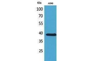 Image no. 1 for anti-Solute Carrier Family 10 (Sodium/bile Acid Cotransporter Family), Member 1 (SLC10A1) (C-Term) antibody (ABIN3187880)