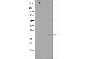 Image no. 1 for anti-Phenylethanolamine N-Methyltransferase (PNMT) antibody (ABIN6264322)