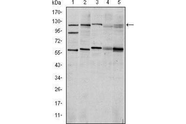 anti-Hypoxia Inducible Factor 1, alpha Subunit (Basic Helix-Loop-Helix Transcription Factor) (HIF1A) antibody