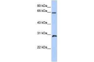 Image no. 4 for anti-Homeobox A5 (HOXA5) (C-Term) antibody (ABIN2781081)