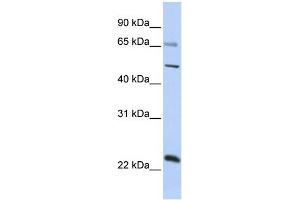 Image no. 1 for anti-Zinc Finger Protein 597 (ZNF597) (Middle Region) antibody (ABIN2775094)