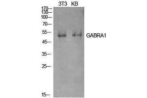 Image no. 1 for anti-gamma-aminobutyric Acid (GABA) A Receptor, alpha 1 (GABRA1) (Internal Region) antibody (ABIN3181422)