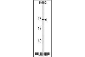 Image no. 1 for anti-Crystallin, gamma D (CRYGD) (AA 73-101) antibody (ABIN1538595)