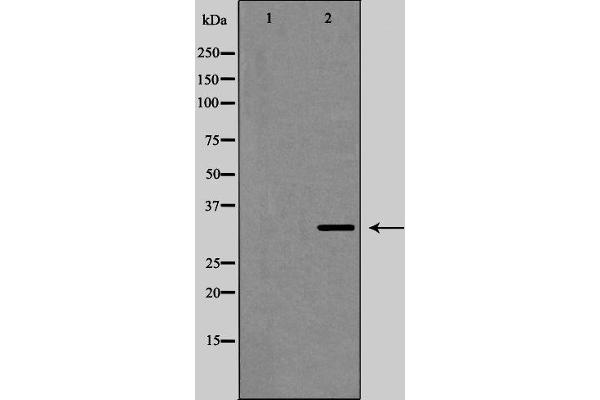 anti-Gap Junction Protein, beta 1, 32kDa (GJB1) (Internal Region) antibody