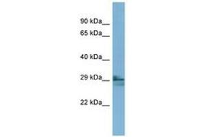 Image no. 1 for anti-Lens Intrinsic Membrane Protein 2, 19kDa (LIM2) (AA 35-84) antibody (ABIN6741876)