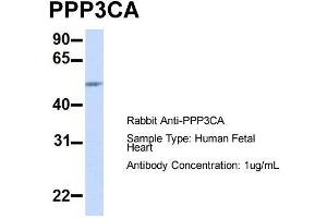 Image no. 2 for anti-Protein Phosphatase 3, Catalytic Subunit, alpha Isoform (PPP3CA) (Middle Region) antibody (ABIN2784524)
