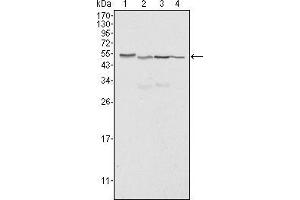 Image no. 2 for anti-Calreticulin (CALR) antibody (ABIN1724687)