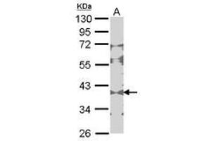 Image no. 1 for anti-Creatine Kinase, Brain (CKB) (AA 66-179) antibody (ABIN467367)