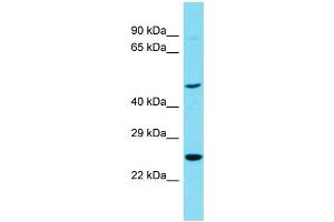 Image no. 1 for anti-Reticulon 4 Receptor-Like 1 (RTN4RL1) (C-Term) antibody (ABIN2774488)