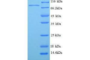 Image no. 1 for phosphoenolpyruvate Carboxykinase 1 (Soluble) (PCK1) (AA 1-622), (full length) protein (His tag) (ABIN5710071)