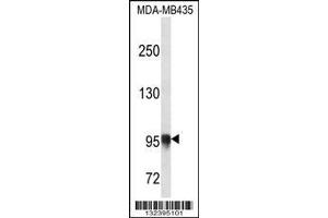 Image no. 1 for anti-Procollagen-Lysine, 2-Oxoglutarate 5-Dioxygenase 3 (PLOD3) (AA 78-105), (N-Term) antibody (ABIN656661)