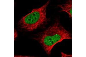 ZNF470 antibody