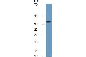 Image no. 2 for Connective Tissue Growth Factor (CTGF) ELISA Kit (ABIN6730903)