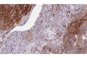 Image no. 1 for anti-S100 Calcium Binding Protein A8 (S100A8) (C-Term) antibody (ABIN6264907)
