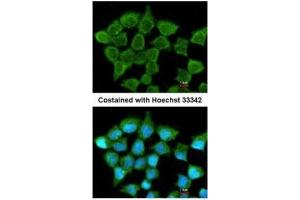 Image no. 2 for anti-Succinate-CoA Ligase, ADP-Forming, beta Subunit (SUCLA2) (Center) antibody (ABIN2856701)