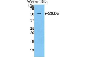 Image no. 1 for anti-Transglutaminase 1, Keratinocyte (TGM1) (AA 504-737) antibody (ABIN1860737)