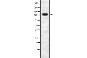 Image no. 1 for anti-Topoisomerase I Binding, arginine/serine-Rich, E3 Ubiquitin Protein Ligase (TOPORS) (C-Term) antibody (ABIN6259220)