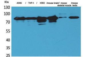 Image no. 1 for anti-Protein Kinase C, gamma (PRKCG) (Internal Region) antibody (ABIN3187692)