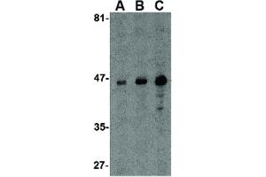 Image no. 2 for anti-MHC Class I Polypeptide-Related Sequence A (MICA) (C-Term) antibody (ABIN6655975)