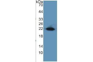 Image no. 5 for Early Growth Response 1 (EGR1) ELISA Kit (ABIN6730895)