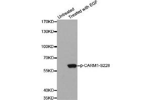 Image no. 2 for anti-Coactivator-Associated Arginine Methyltransferase 1 (CARM1) (pSer228) antibody (ABIN3020121)
