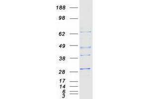 Image no. 1 for Proteasome (Prosome, Macropain) Subunit, beta Type, 4 (PSMB4) protein (Myc-DYKDDDDK Tag) (ABIN2729933)