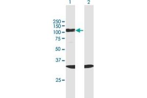 Image no. 1 for anti-Splicing Factor 3b, Subunit 2, 145kDa (SF3B2) (AA 1-636) antibody (ABIN949022)