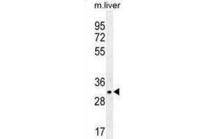 Image no. 1 for anti-JAZF Zinc Finger 1 (JAZF1) antibody (ABIN2996323)