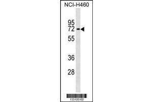 Image no. 1 for anti-Interleukin 28 Receptor, alpha (Interferon, lambda Receptor) (IL28RA) (C-Term) antibody (ABIN2487973)