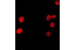 Image no. 3 for anti-Hepatoma-Derived Growth Factor-Related Protein 2 (HDGFRP2) (full length) antibody (ABIN6004738)
