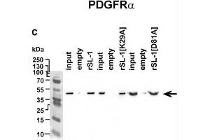 Image no. 1 for anti-Platelet-Derived Growth Factor Receptor, alpha Polypeptide (PDGFRA) (AA 179-361) antibody (ABIN5611263)