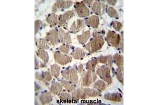 COCH antibody  (Middle Region)