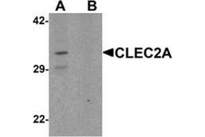 anti-C-Type Lectin Domain Family 2, Member A (CLEC2A) (N-Term) antibody